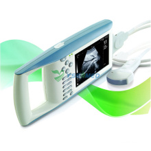 Handheld Full Digital Veterinary Ultrasound Scanner
